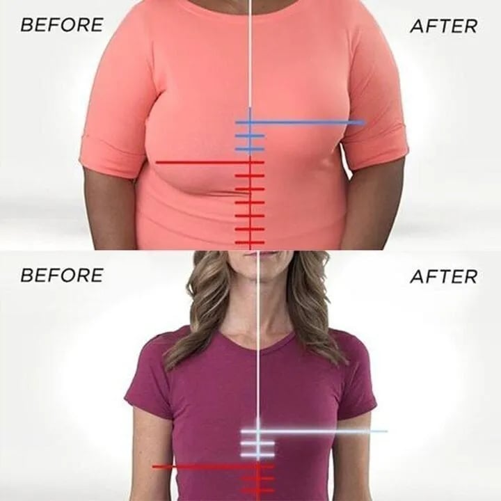 Miri™ | SoftSupport Bra